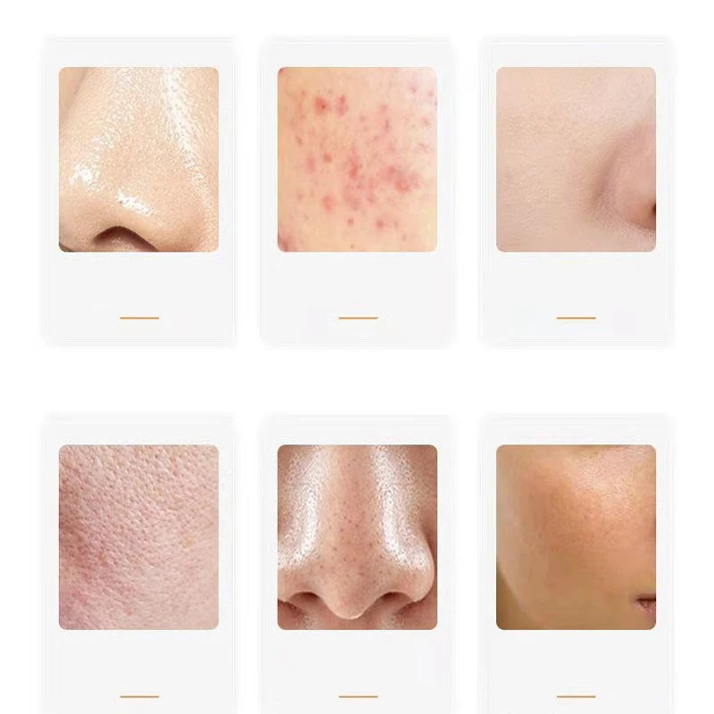 Natural Volcanic Roller Oil Control Rolling Stone Matte Makeup Face Skin Care Tool Face Cleaning Oil Absorption Roller On Ball